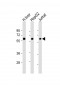 CYP2E1 Antibody (Center)